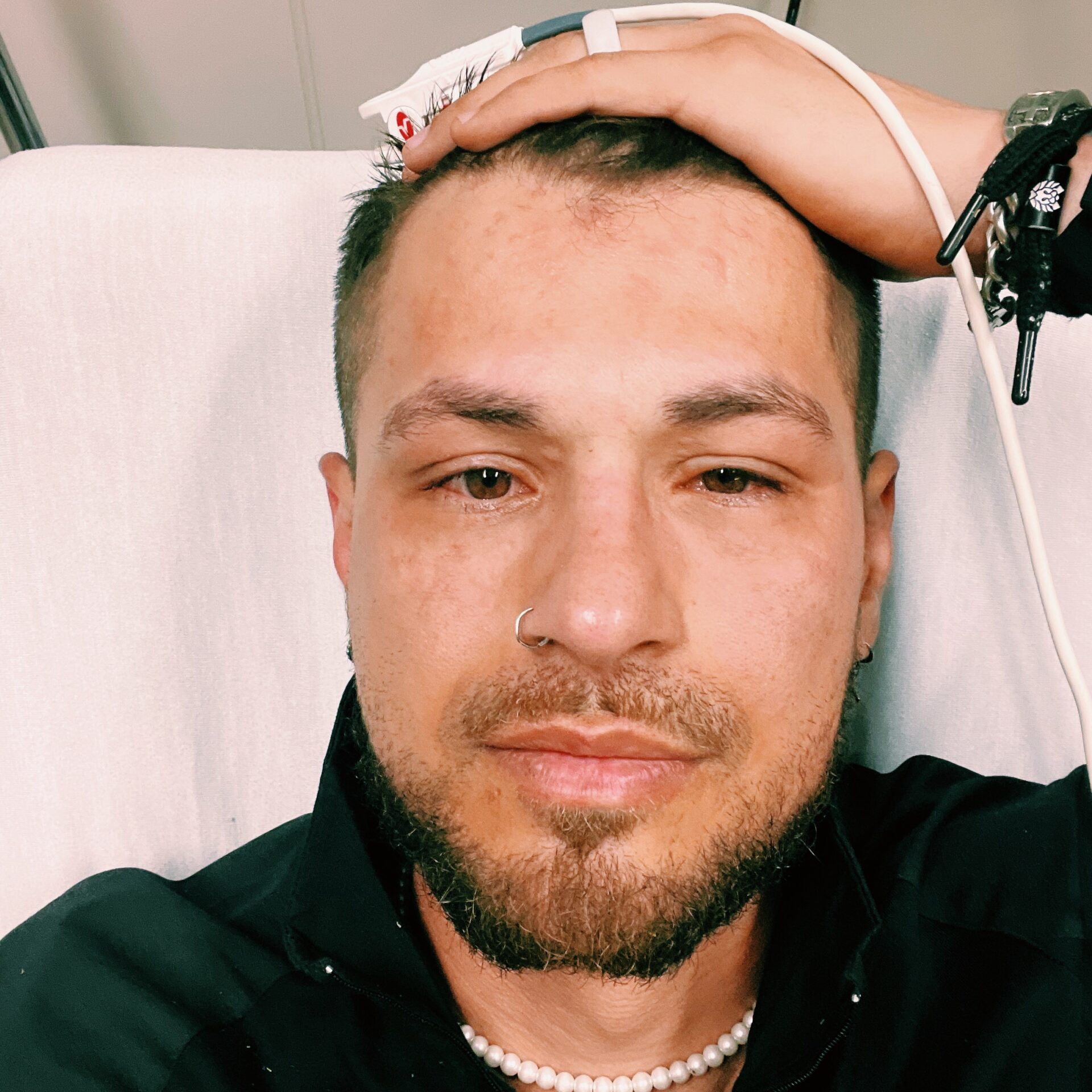 James goes to hospital after an alergic reaction.